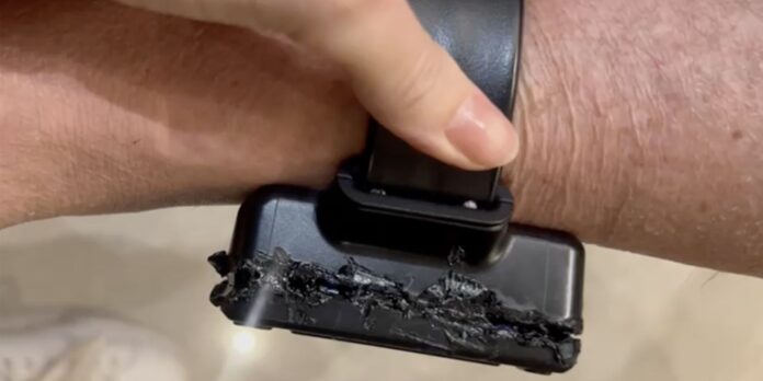 Bolsonaro usou ferro de solda para tentar abrir tornozeleira Bolsonaro usou ferro de solda para tentar abrir tornozeleira