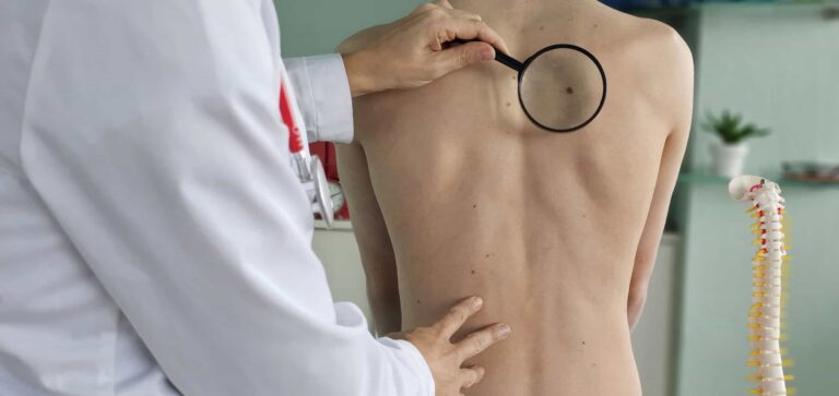 Tratamento promissor para câncer de pele está em testes no Brasil
